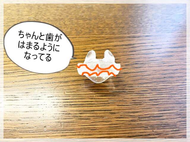 上の歯と下の歯をマウスピースにはめて矯正する
